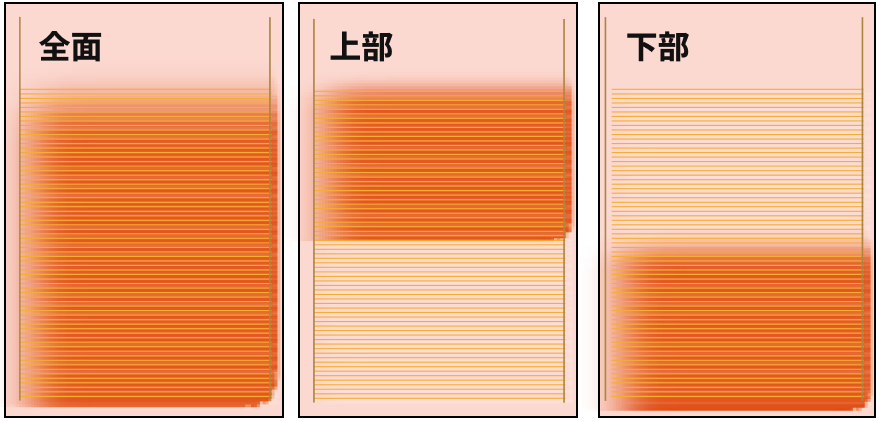 全面/上部/下部